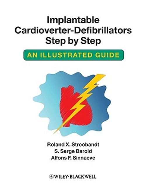 Implantable Cardioverter – Defibrillators Step by Step (Paperback or Softback)
