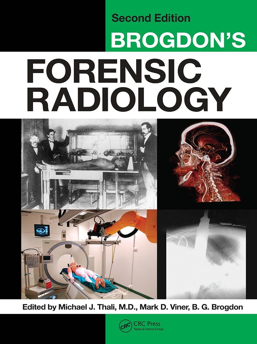 Brogdon’s Forensic Radiology