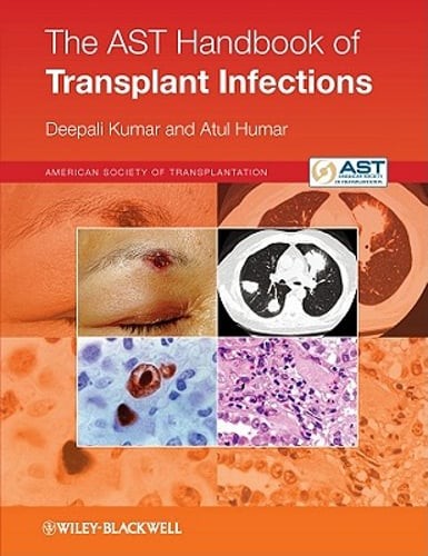 The AST Handbook of Transplant Infections by Deepali Kumar: Used