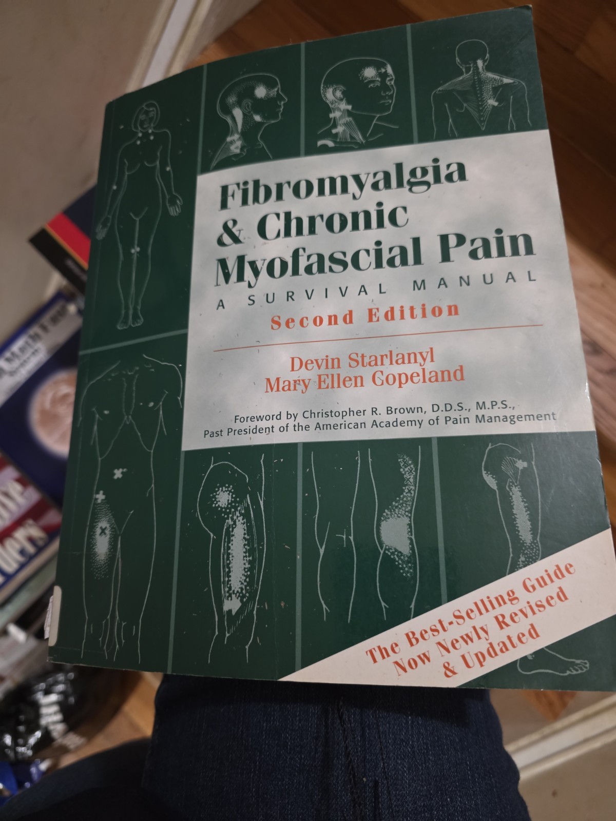 Fibromyalgia and Chronic Myofascial Pain Survival Manual Starlanyl and Copeland