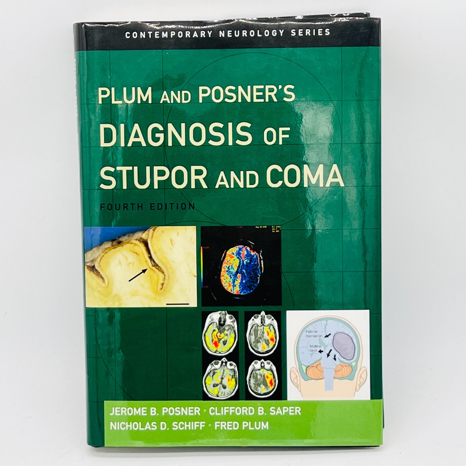 Plum and Posner’s Diagnosis of Stupor and Coma (Contemporary Neurology Series 7)