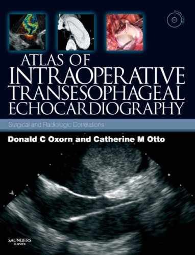 Atlas of Intraoperative – Hardcover, by Otto MD Catherine – Very Good