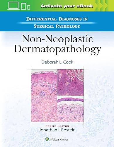 Differential Diagnoses in Surgical Pathology: Non-Neoplastic D…