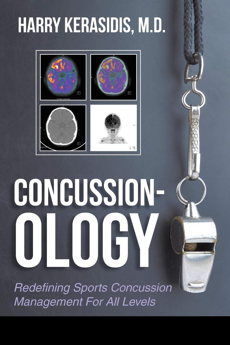Concussionology: Redefining Sports Concussion Management For All Levels