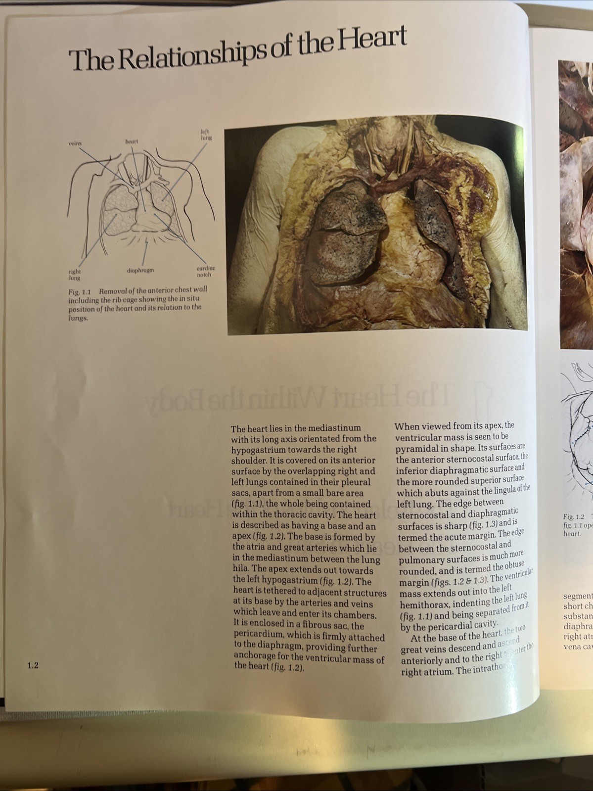 Cardiac Anatomy: An Integrated Text and Color Atlas by Robert Anderson- 1980 -B2