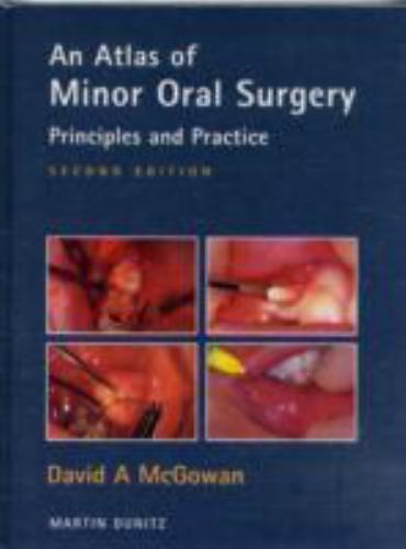 An Atlas of Minor Oral Surgery: Principles and Practice