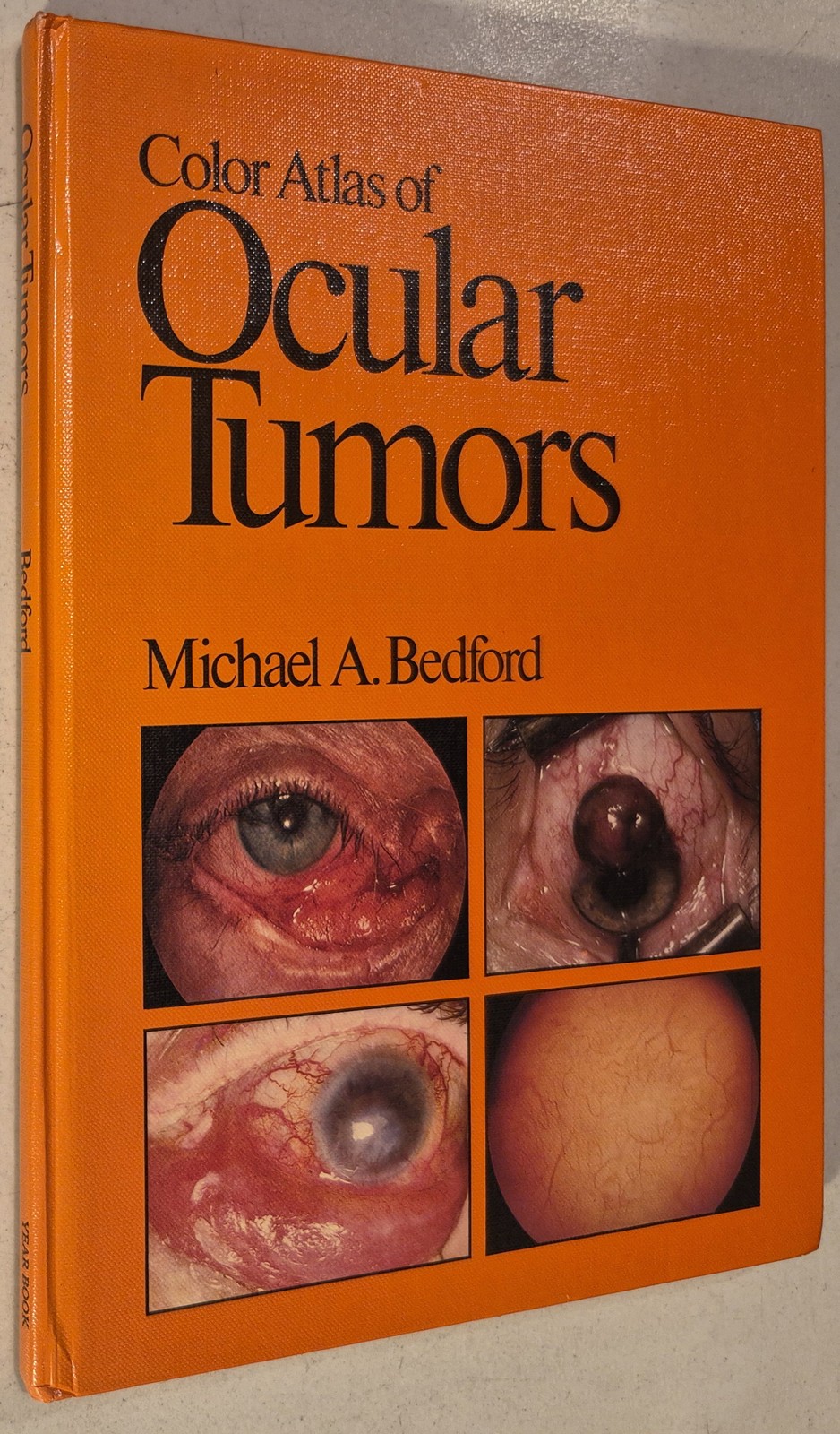 Color atlas of ocular tumors