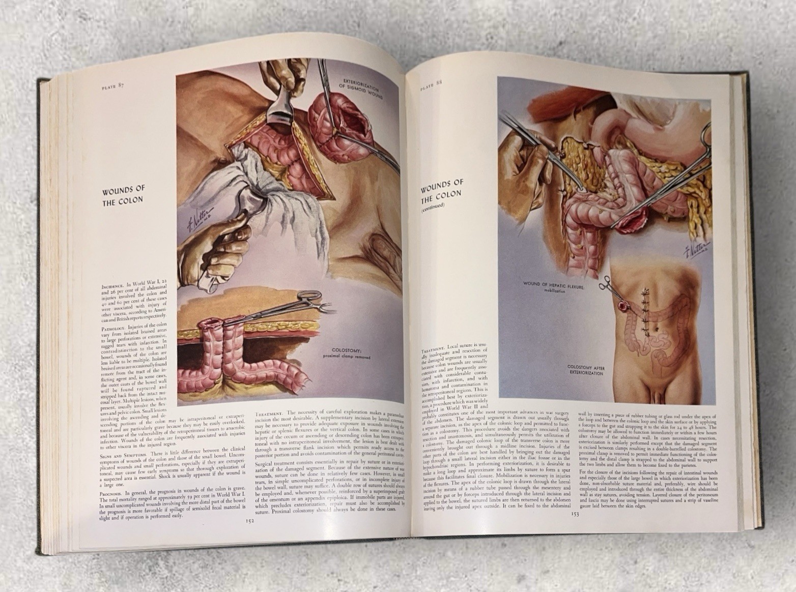1st Edition THE CIBA COLLECTION OF MEDICAL ILLUSTRATIONS Frank H Netter MD 1948