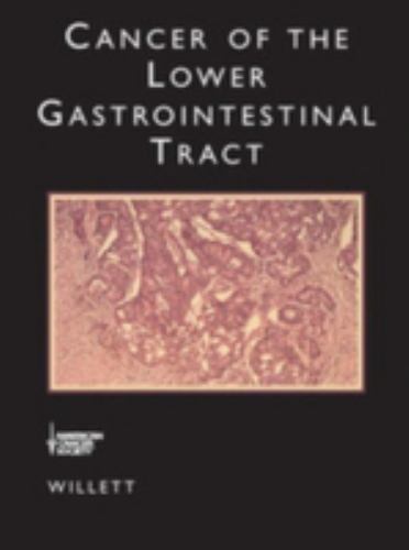 Cancer of the Lower Gastrointestinal Tract (Atlas of Clinical Oncology)