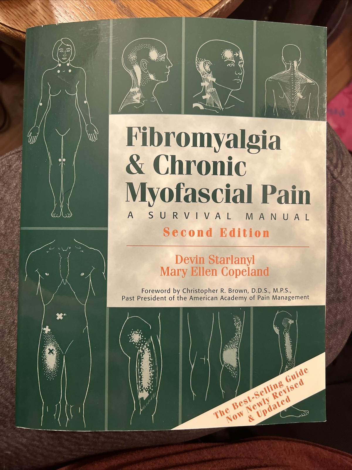 Fibromyalgia and Chronic Myofascial Pain: A Survival Manual [2nd Edition] , C7