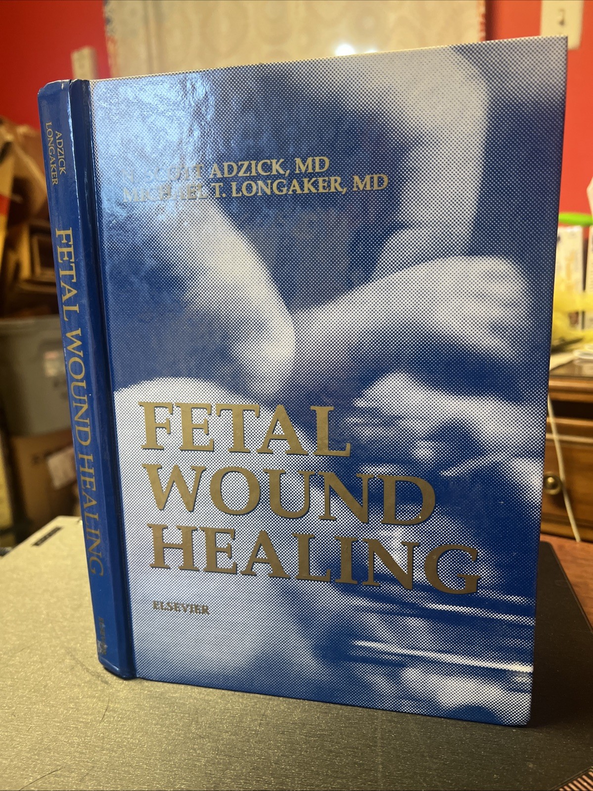 Fetal wound healing Adzick, N. Scott, MD/Longaker, Michael T., MD