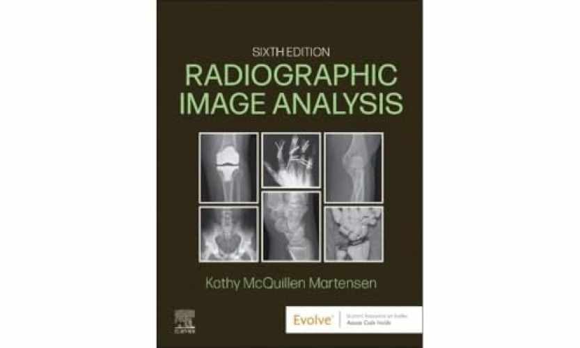 Radiographic Image Analysis – Hardcover, by Martensen MA RT(R) – Very Good v