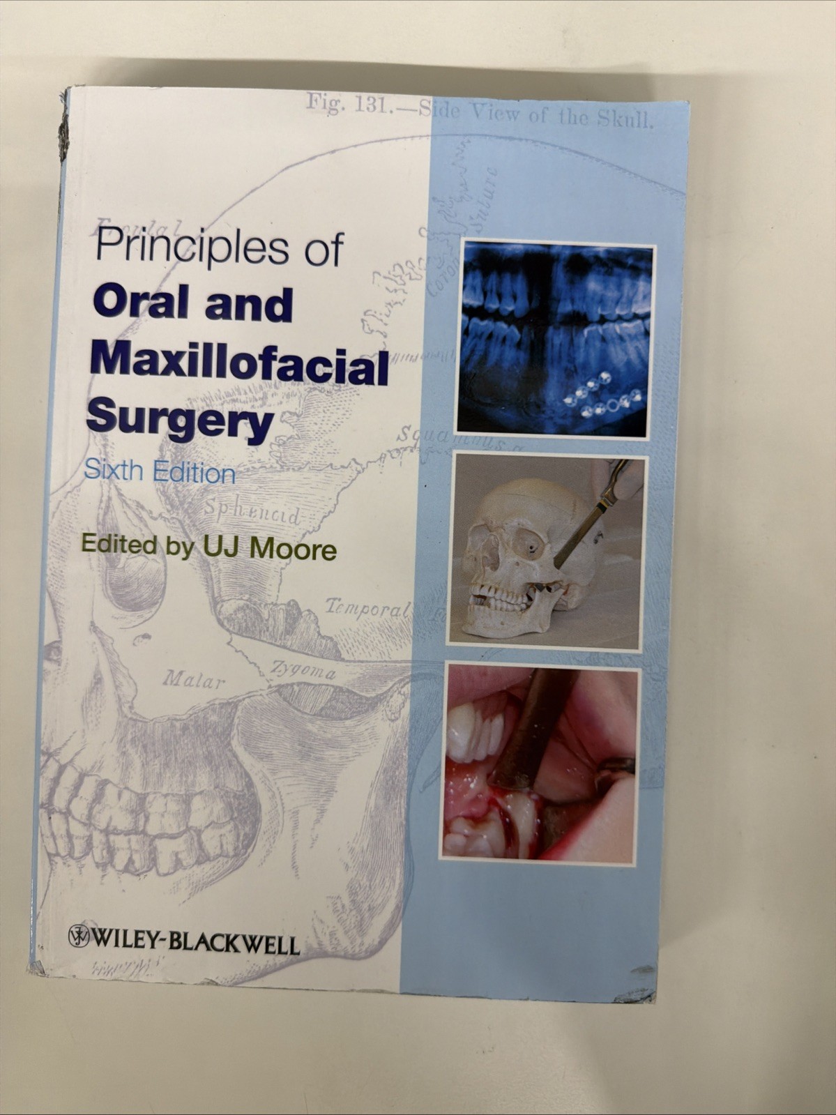 Principles of Oral and Maxillofacial Surgery