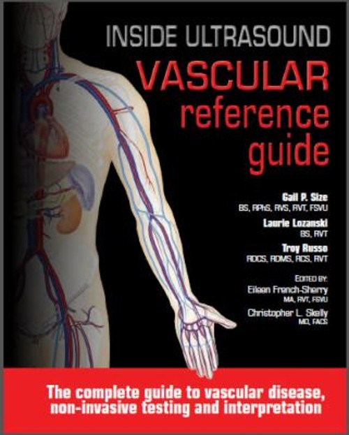 Inside Ultrasound Vascular Reference Guide Spiral Gail Size