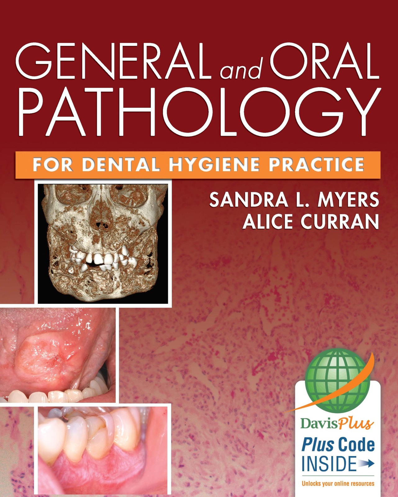 General and Oral Pathology for Dental Hygiene Practice by Sandra L. Myers DMD