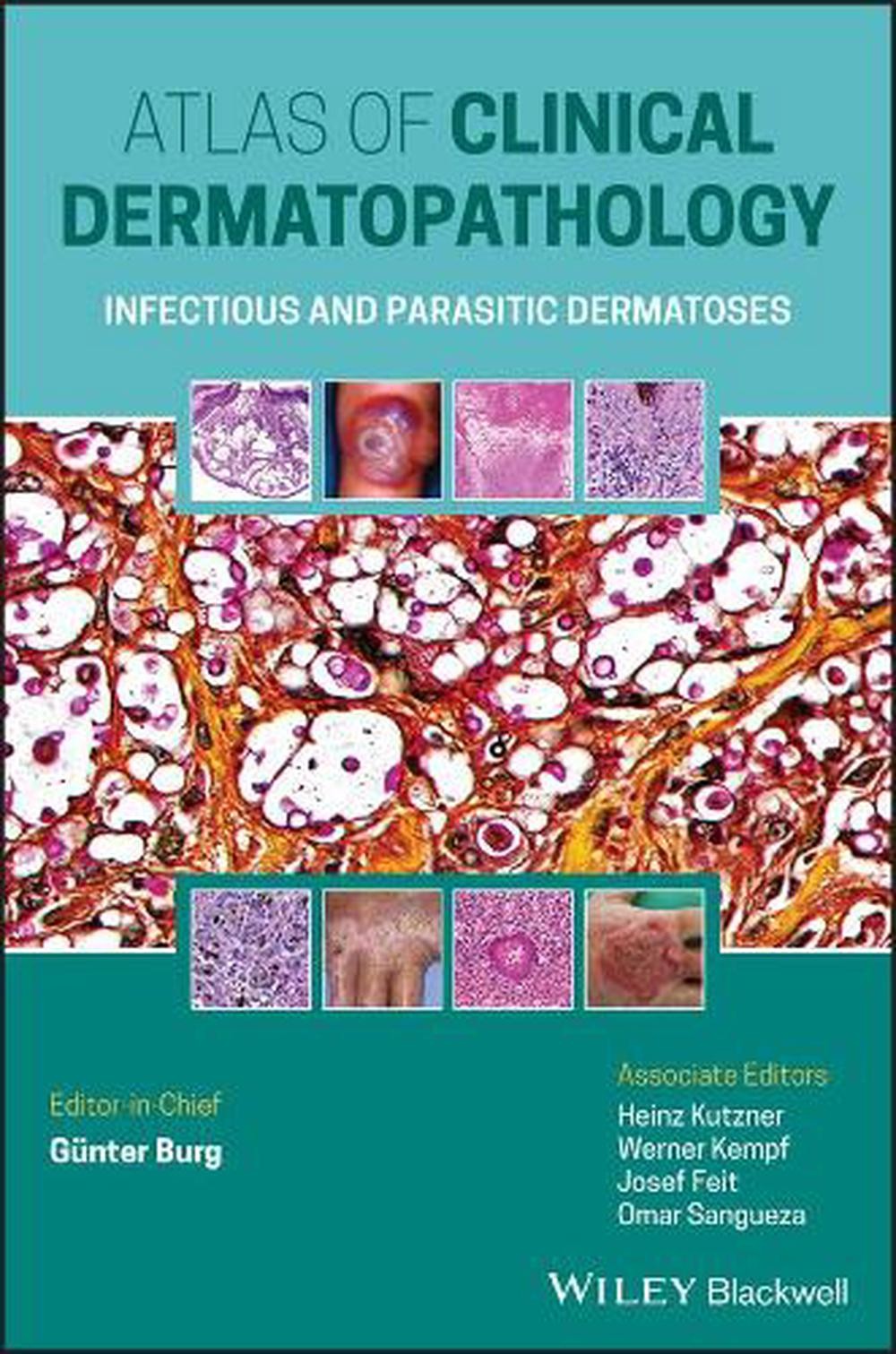 Atlas of Clinical Dermatopathology: Infectious and Parasitic Dermatoses by G?nte