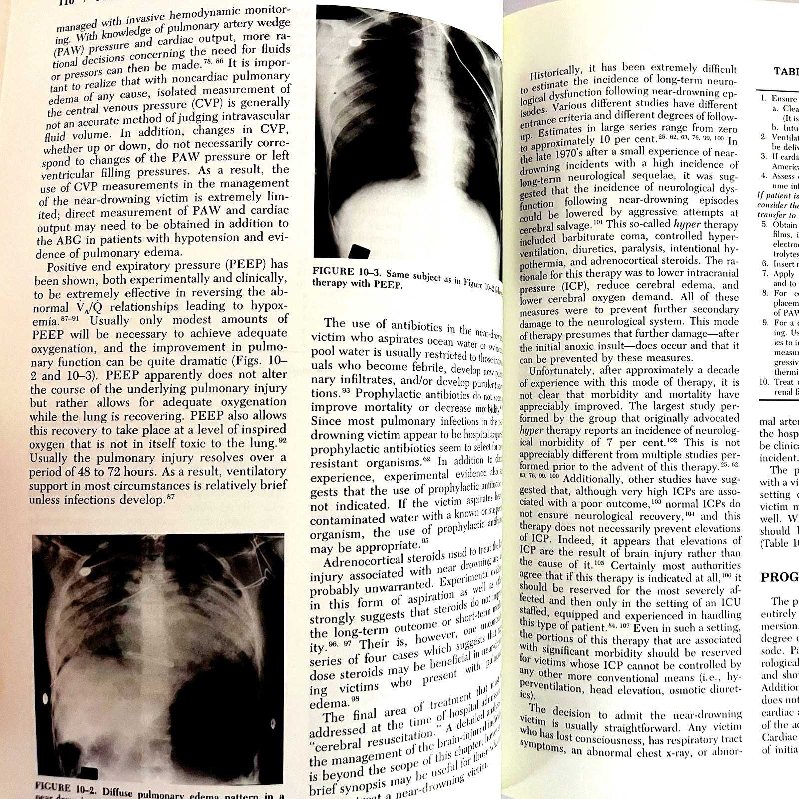 Vintage Diving Medicine Book for Divers Hardcover by Alfred A. Bove 1990