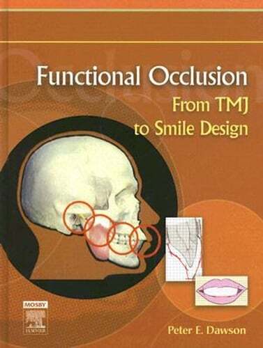 Functional Occlusion: From Tmj to Smile Design by Peter E Dawson: Used