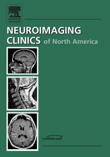 Advanced Pediatric Neuroimaging (Neuroimaging Clinics: Volume 16, Number 1, …