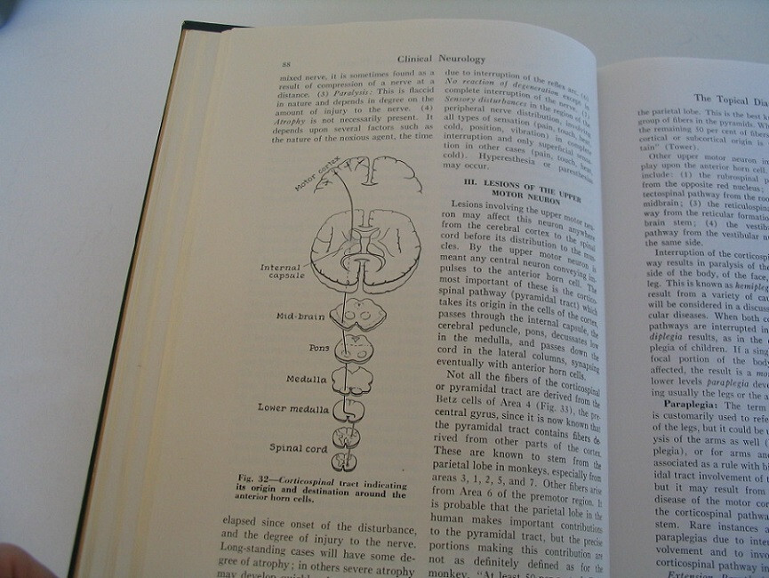 CLINICAL NEUROLOGY BERNARD ALPERS 4TH EDITION 890 PAGES 244 ILLUSTRATIONS HB